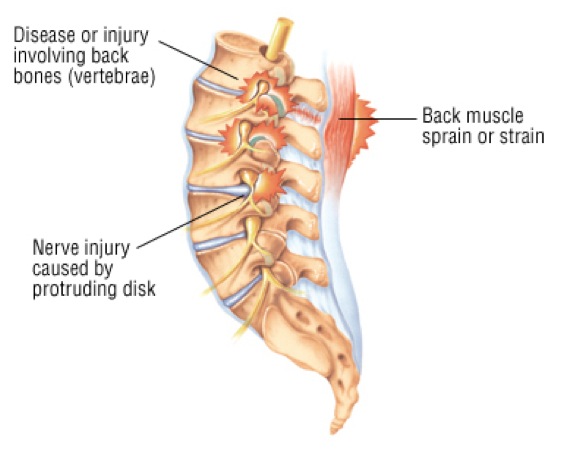 Damian Warner SUP injuries 